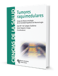 Tumores raquimedulares