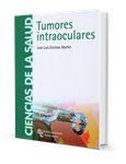 Tumores intraoculares