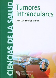 Tumores intraoculares